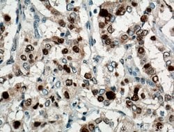 P21 Rabbit anti-Human, Polyclonal, Proteintech:Antibodies:Primary Antibodies