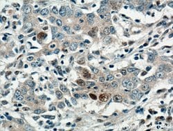 P21 Rabbit anti-Human, Polyclonal, Proteintech:Antibodies:Primary Antibodies