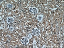 P21 Rabbit anti-Human, Polyclonal, Proteintech:Antibodies:Primary Antibodies