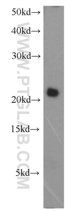 P21 Rabbit anti-Human, Polyclonal, Proteintech:Antibodies:Primary Antibodies