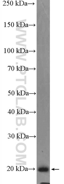 P21 Rabbit anti-Human, Polyclonal, Proteintech:Antibodies:Primary Antibodies