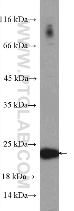 P21 Rabbit anti-Human, Polyclonal, Proteintech:Antibodies:Primary Antibodies