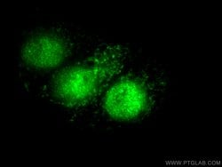 P21 Rabbit anti-Human, Polyclonal, Proteintech:Antibodies:Primary Antibodies