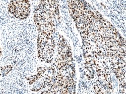 P21 Rabbit anti-Human, Polyclonal, Proteintech:Antibodies:Primary Antibodies