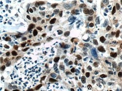 P21 Rabbit anti-Human, Polyclonal, Proteintech:Antibodies:Primary Antibodies