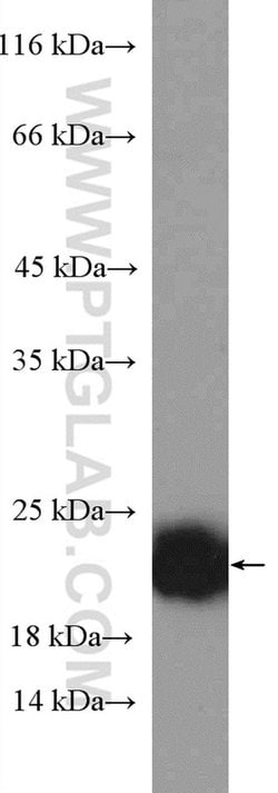 P21 Rabbit anti-Human, Polyclonal, Proteintech:Antibodies:Primary Antibodies