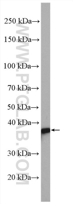 MAPRE2 Rabbit anti-Human, Mouse, Rat, Polyclonal, Proteintech:Anticorps:Anticorps