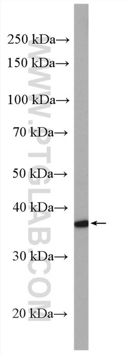 MAPRE2 Rabbit anti-Human, Mouse, Rat, Polyclonal, Proteintech:Anticorps:Anticorps