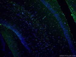 Vimentin Rabbit anti-Human, Mouse, Rat, Polyclonal, Proteintech:Antikörper:Primärantikörper