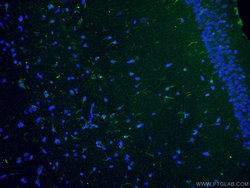 Vimentin Rabbit anti-Human, Mouse, Rat, Polyclonal, Proteintech:Antikörper:Primärantikörper