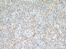 Vimentin Rabbit anti-Human, Mouse, Rat, Polyclonal, Proteintech:Antikörper:Primärantikörper