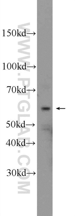 Vimentin Rabbit anti-Human, Mouse, Rat, Polyclonal, Proteintech:Antikörper:Primärantikörper