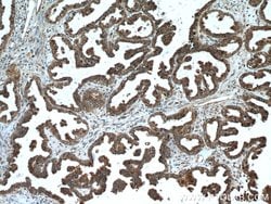 ALDH7A1 Rabbit anti-Human, Mouse, Rat, Polyclonal, Proteintech:Antibodies:Primary