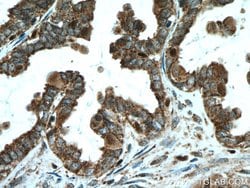 ALDH7A1 Rabbit anti-Human, Mouse, Rat, Polyclonal, Proteintech:Antibodies:Primary
