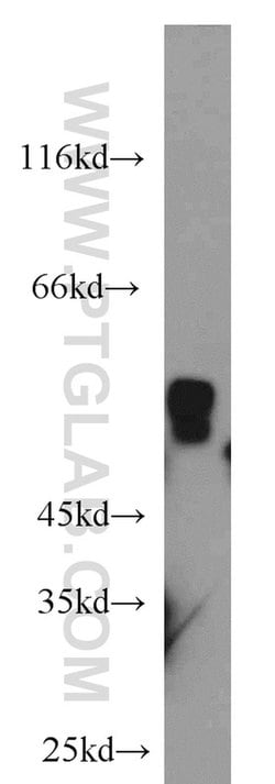ALDH7A1 Rabbit anti-Human, Mouse, Rat, Polyclonal, Proteintech:Antibodies:Primary