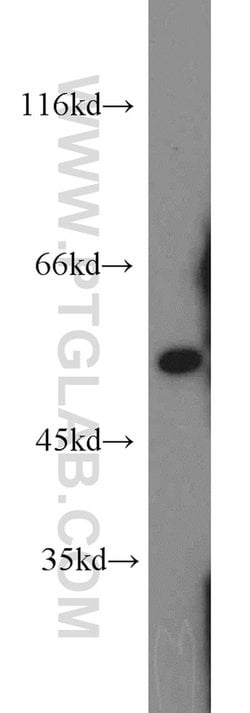 ALDH7A1 Rabbit anti-Human, Mouse, Rat, Polyclonal, Proteintech:Antibodies:Primary
