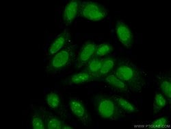 Proteintech MMP2 Rabbit anti-Human, Mouse, Rat, Zebrafish, Polyclonal, Proteintech