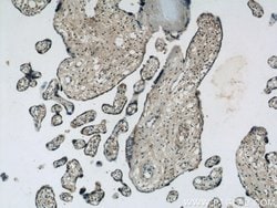 MMP2 Rabbit anti-Human, Mouse, Rat, Zebrafish, Polyclonal, Proteintech:Antikörper:Primärantikörper