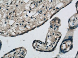 MMP2 Rabbit anti-Human, Mouse, Rat, Zebrafish, Polyclonal, Proteintech:Antikörper:Primärantikörper