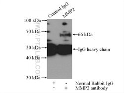 MMP2 Rabbit anti-Human, Mouse, Rat, Zebrafish, Polyclonal, Proteintech:Antikörper:Primärantikörper