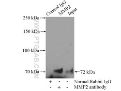 MMP2 Rabbit anti-Human, Mouse, Rat, Zebrafish, Polyclonal, Proteintech:Antikörper:Primärantikörper