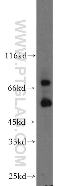 MMP2 Rabbit anti-Human, Mouse, Rat, Zebrafish, Polyclonal, Proteintech:Antikörper:Primärantikörper