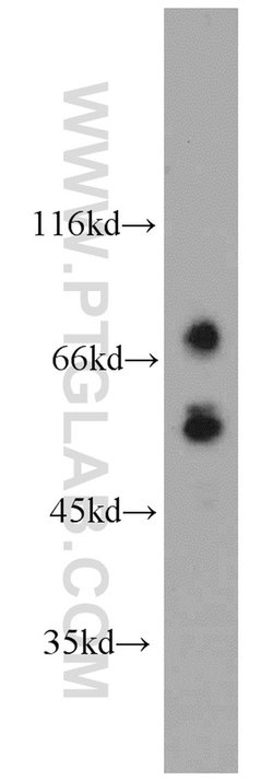 MMP2 Rabbit anti-Human, Mouse, Rat, Zebrafish, Polyclonal, Proteintech:Antikörper:Primärantikörper