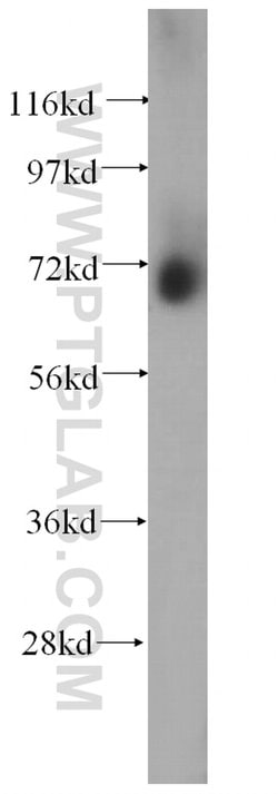 MMP2 Rabbit anti-Human, Mouse, Rat, Zebrafish, Polyclonal, Proteintech:Antikörper:Primärantikörper