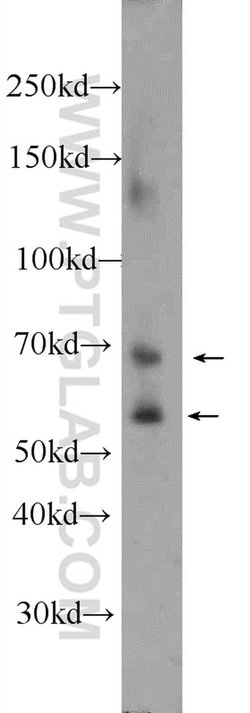 MMP2 Rabbit anti-Human, Mouse, Rat, Zebrafish, Polyclonal, Proteintech:Antikörper:Primärantikörper