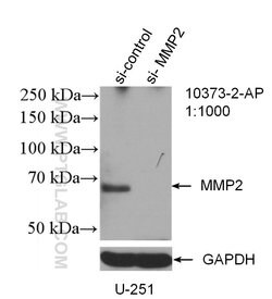 MMP2 Rabbit anti-Human, Mouse, Rat, Zebrafish, Polyclonal, Proteintech:Antikörper:Primärantikörper
