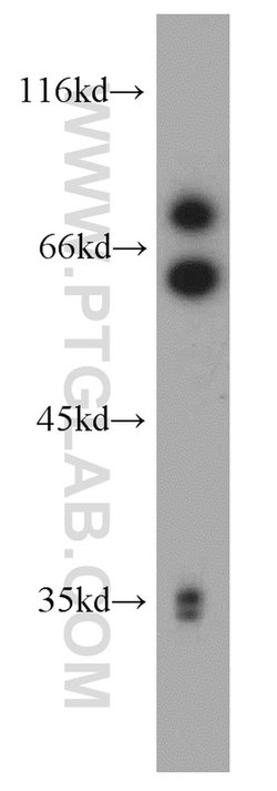 MMP2 Rabbit anti-Human, Mouse, Rat, Zebrafish, Polyclonal, Proteintech:Antikörper:Primärantikörper