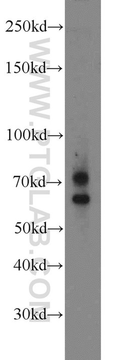 MMP2 Rabbit anti-Human, Mouse, Rat, Zebrafish, Polyclonal, Proteintech:Antikörper:Primärantikörper