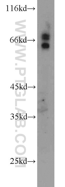 MMP2 Rabbit anti-Human, Mouse, Rat, Zebrafish, Polyclonal, Proteintech:Antikörper:Primärantikörper