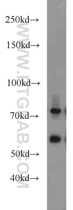 MMP2 Rabbit anti-Human, Mouse, Rat, Zebrafish, Polyclonal, Proteintech:Antikörper:Primärantikörper