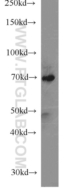 MMP2 Rabbit anti-Human, Mouse, Rat, Zebrafish, Polyclonal, Proteintech:Antikörper:Primärantikörper