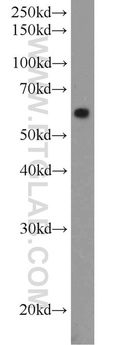 MMP2 Rabbit anti-Human, Mouse, Rat, Zebrafish, Polyclonal, Proteintech:Antikörper:Primärantikörper