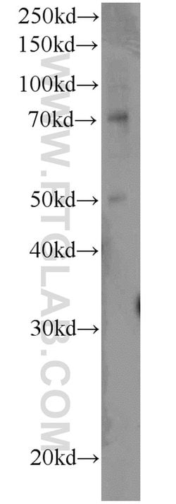 MMP2 Rabbit anti-Human, Mouse, Rat, Zebrafish, Polyclonal, Proteintech:Antikörper:Primärantikörper