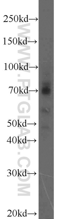 MMP2 Rabbit anti-Human, Mouse, Rat, Zebrafish, Polyclonal, Proteintech:Antikörper:Primärantikörper