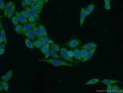 MMP9 (N-terminal) Rabbit anti-Human, Mouse, Rat, Zebrafish, Polyclonal,