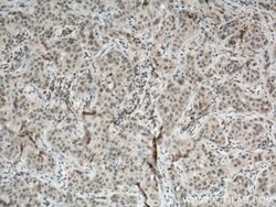MMP9 (N-terminal) Rabbit anti-Human, Mouse, Rat, Zebrafish, Polyclonal,