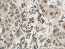 MMP9 (N-terminal) Rabbit anti-Human, Mouse, Rat, Zebrafish, Polyclonal,