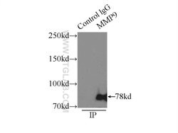 MMP9 (N-terminal) Rabbit anti-Human, Mouse, Rat, Zebrafish, Polyclonal,