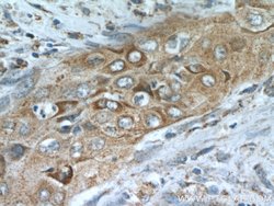 MMP9 (N-terminal) Rabbit anti-Human, Mouse, Rat, Zebrafish, Polyclonal,