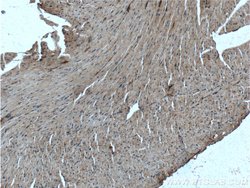 MMP9 (N-terminal) Rabbit anti-Human, Mouse, Rat, Zebrafish, Polyclonal,