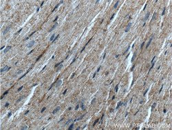 MMP9 (N-terminal) Rabbit anti-Human, Mouse, Rat, Zebrafish, Polyclonal,