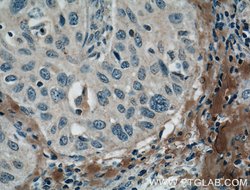 MMP9 (N-terminal) Rabbit anti-Human, Mouse, Rat, Zebrafish, Polyclonal,