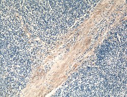 MMP9 (N-terminal) Rabbit anti-Human, Mouse, Rat, Zebrafish, Polyclonal,