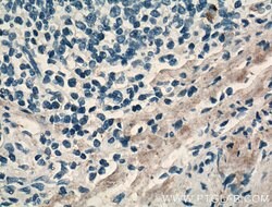 MMP9 (N-terminal) Rabbit anti-Human, Mouse, Rat, Zebrafish, Polyclonal,
