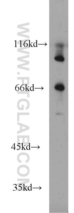 MMP9 (N-terminal) Rabbit anti-Human, Mouse, Rat, Zebrafish, Polyclonal,