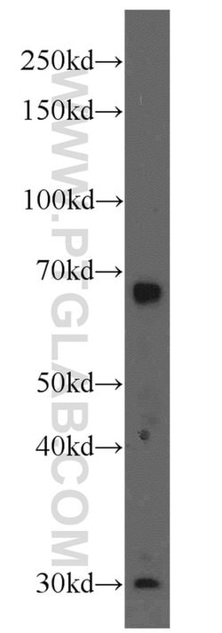 MMP9 (N-terminal) Rabbit anti-Human, Mouse, Rat, Zebrafish, Polyclonal,